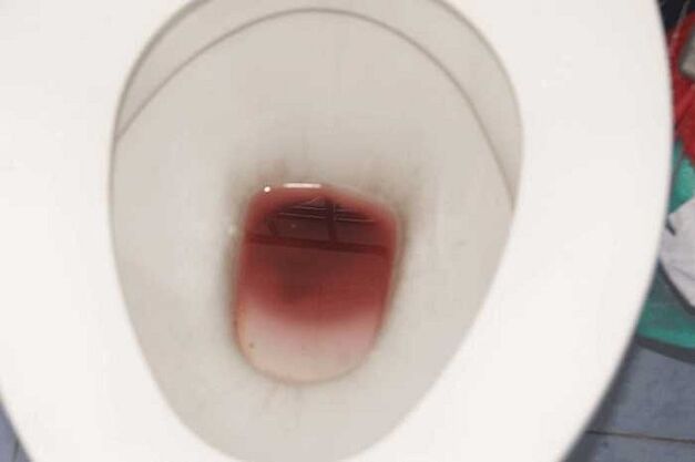 taches sur les hommes lorsqu'ils sont excités